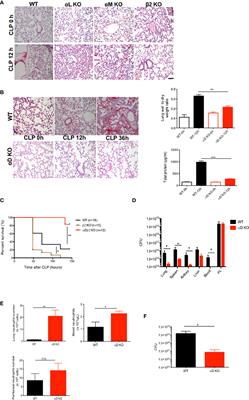 αDβ2 as a novel target of experimental polymicrobial sepsis
